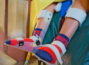 Orthosis-Muscular Dystrophy