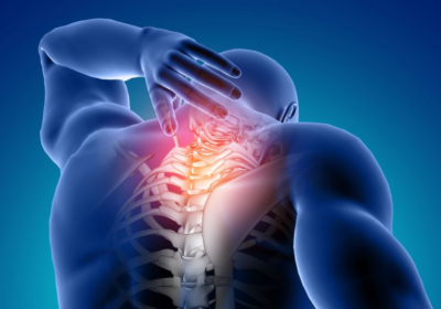 SYRINGOMYELIA