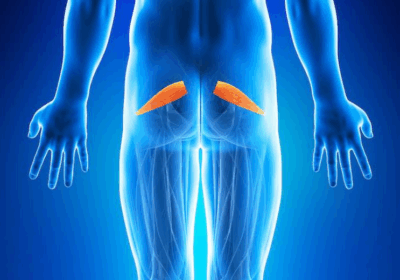 PIRIFORMIS SYNDROME