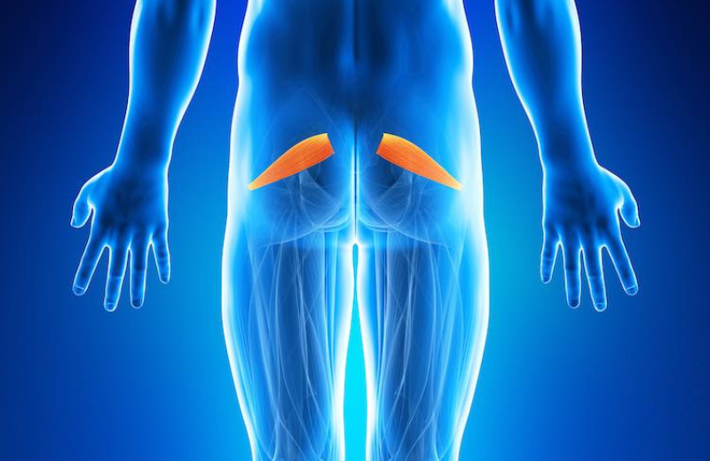 PIRIFORMIS SYNDROME