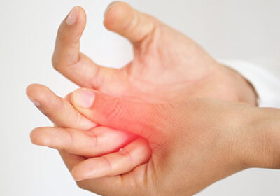 Rheumatoid Arthritis